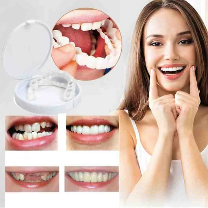 Facettes dentaires amovibles pour un sourire parfait - Foivo