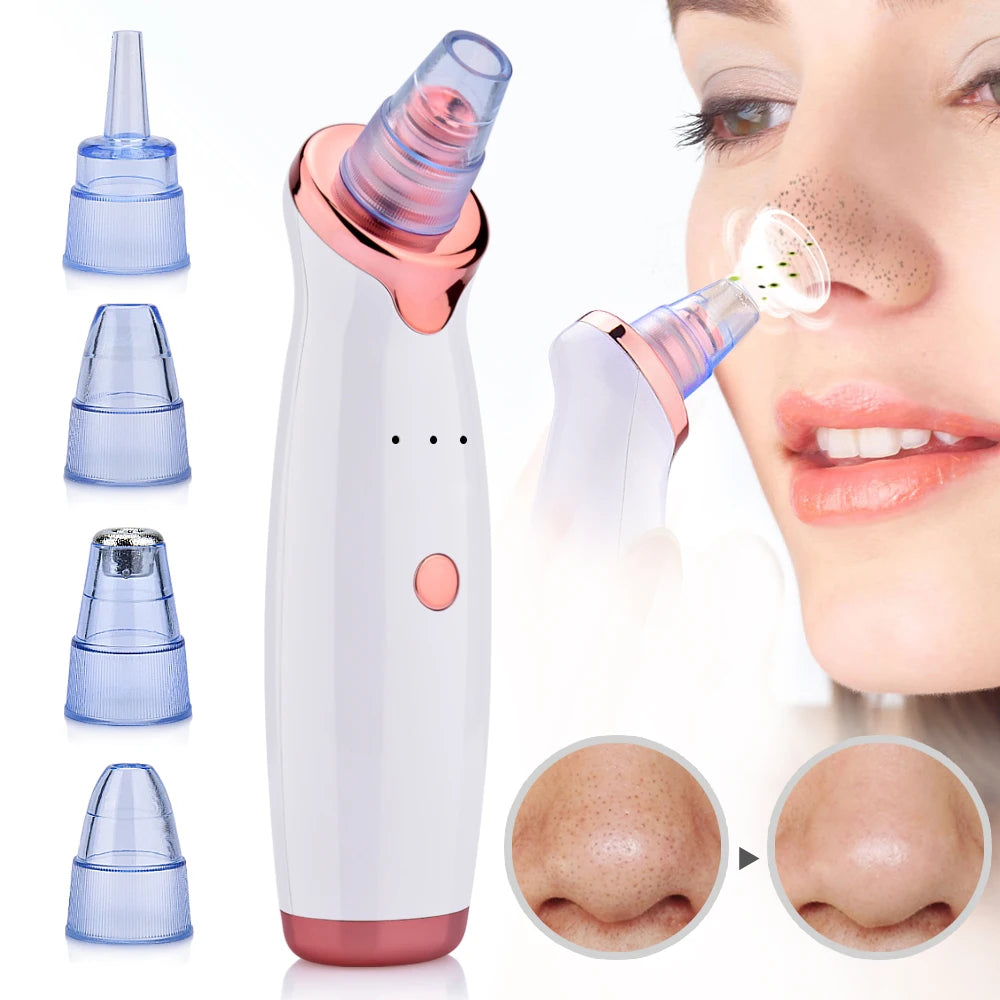 Aspirateur de points noirs Facial Profond - Foivo