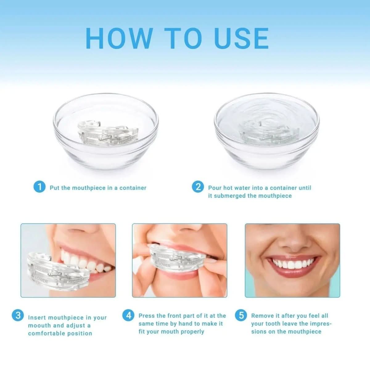 Embout Buccal Anti-Ronflement Personnalisable 1