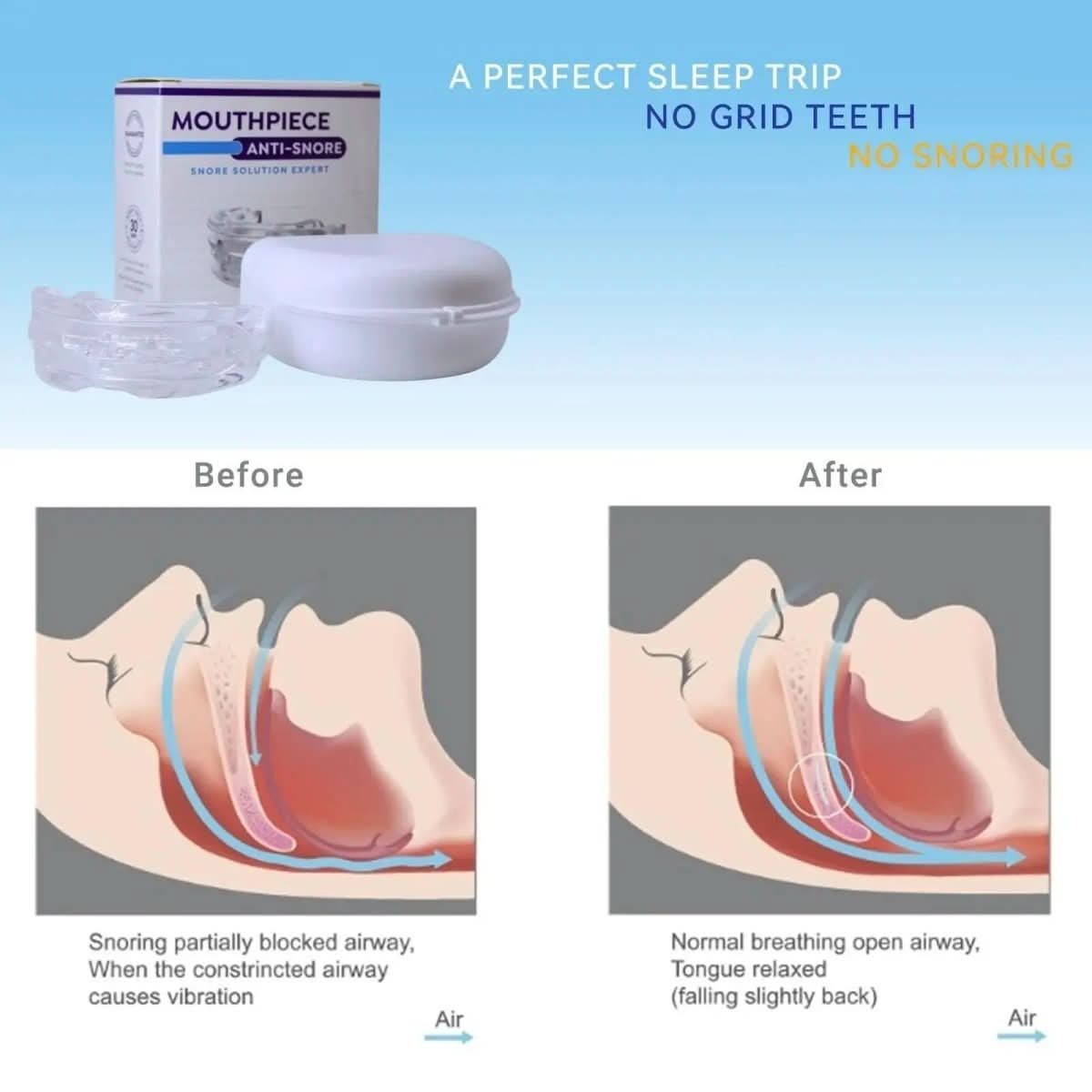 Embout Buccal Anti-Ronflement Personnalisable 2