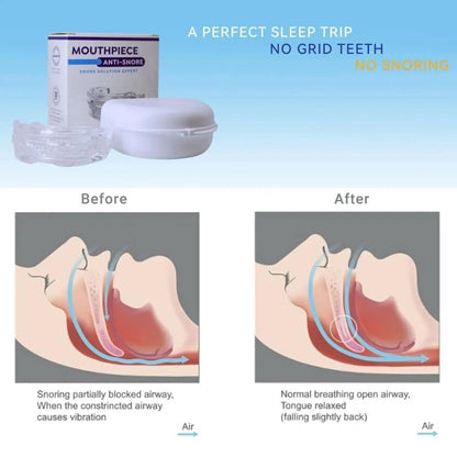 Embout Buccal Anti-Ronflement Personnalisable 2