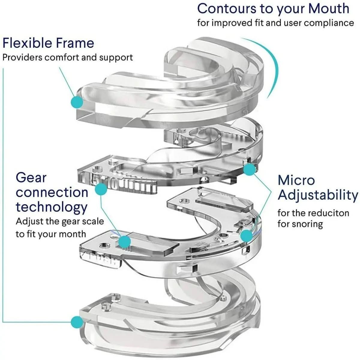 Embout Buccal Anti-Ronflement Personnalisable 4
