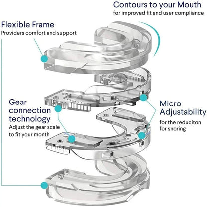 Embout Buccal Anti-Ronflement Personnalisable 4