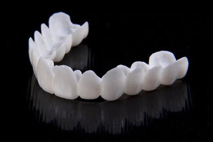 Facettes Dentaires DentAlign – Ajustement Naturel et Confortable, Matériau Composite Durable, Amélioration Rapide du Sourire 5