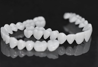 Facettes Dentaires DentAlign – Ajustement Naturel et Confortable, Matériau Composite Durable, Amélioration Rapide du Sourire 6
