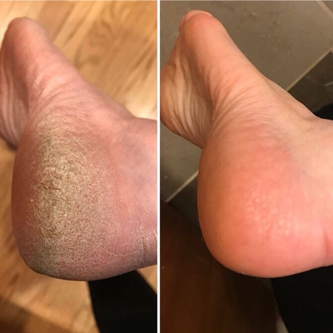 Lime À Pieds Électrique Avec Tête Rotative 360° Pour Soin Rapide 2
