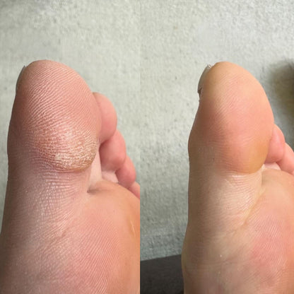 Lime À Pieds Électrique Avec Tête Rotative 360° Pour Soin Rapide 3