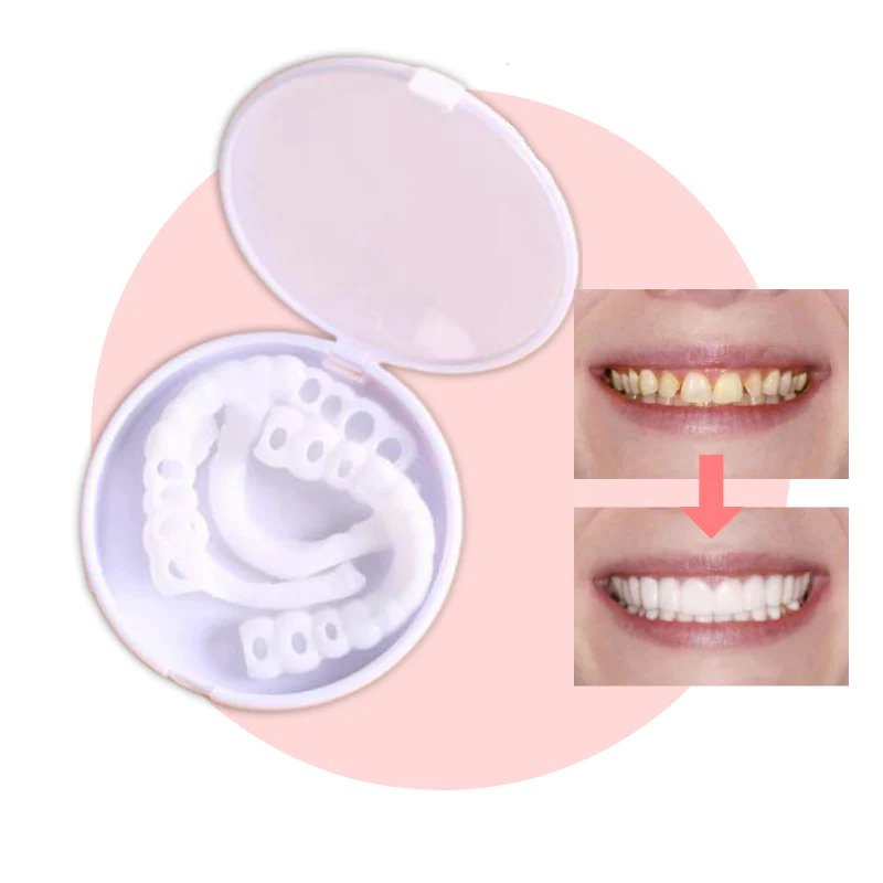 Facettes Dentaires Amovibles pour un Sourire Éclatant - Foivo